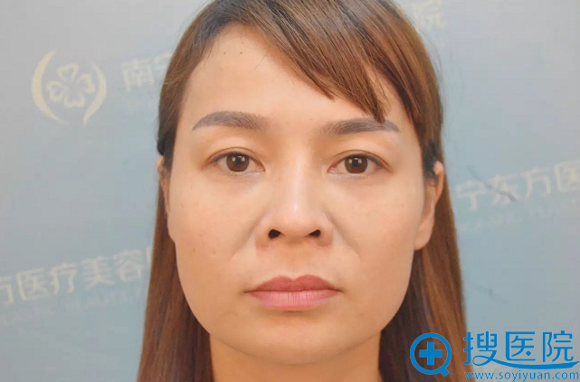 做线雕之前的照片 做线雕之前的照片