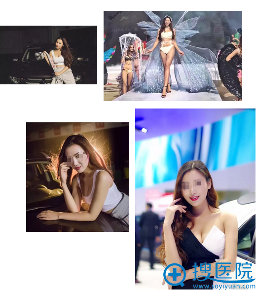 在伊莱美做完隆鼻后的工作照 在伊莱美做完隆鼻后的工作照