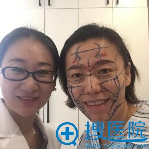 做自体脂肪填充手术前与医生合影 做自体脂肪填充手术前与医生合影