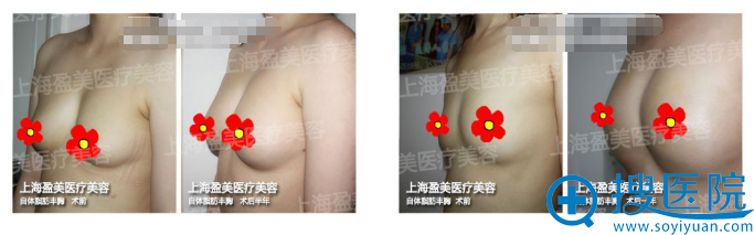 �Ϻ�ӯ���������֬��¡�ذ���