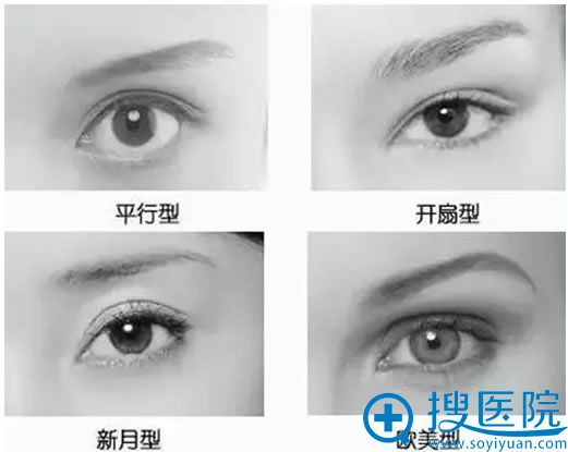 双眼皮有哪些好看的形状 双眼皮有哪些好看的形状