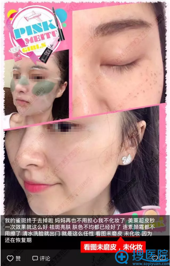 �ɶ�������Ƥ�������ʵ����