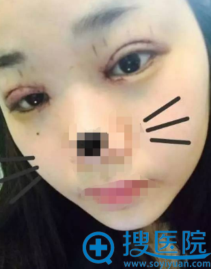 ���ط��п�˫��Ƥ+�����۽����󼴿�