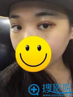 ֣�ݷ��վ��ط�˫��Ƥ+���۽ǲ���Ч��