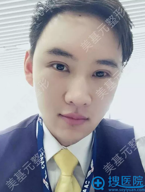 ˫��Ƥ�ڰ��첻�Ǻ�����