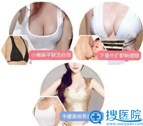 天津丽人整形医院假体隆胸养成记 给你呼之欲出的翘挺胸部