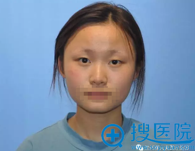 �޾꺫ʽ�ǹ�����ǰ��