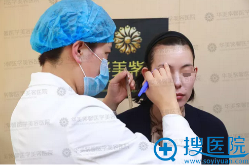 面部线雕提升术前设计 面部线雕提升术前设计