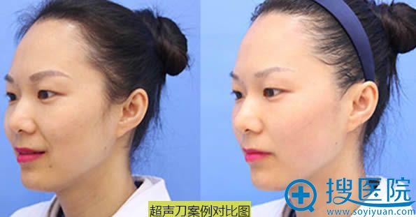 华美刘文先院长案例图 华美刘文先院长案例图
