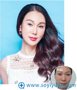 郑州集美美肤案例 郑州集美美肤案例