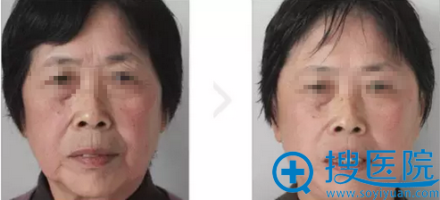 <!--<i data=20240710 data-id=12764></i>-->超级魔法提拉案例对比图 <!--<i data=20240710 data-id=12764></i>-->超级魔法提拉案例对比图
