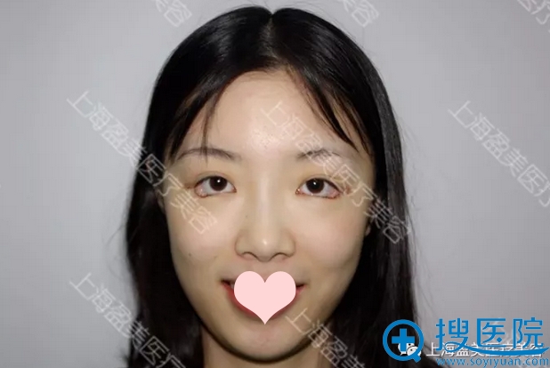 �Ϻ�ӯ��������������������