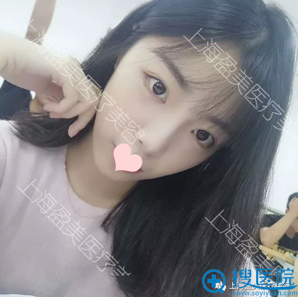 ���Ϻ�ӯ������������������1��������