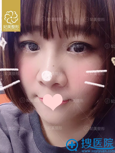 <!--<i data=20240710 data-id=8540></i>-->¡��������������