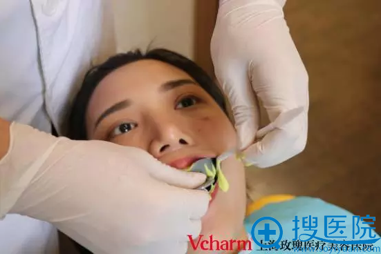 上海那里做牙齿矫正好?上海玫瑰牙齿隐形矫正案例全过程分享
