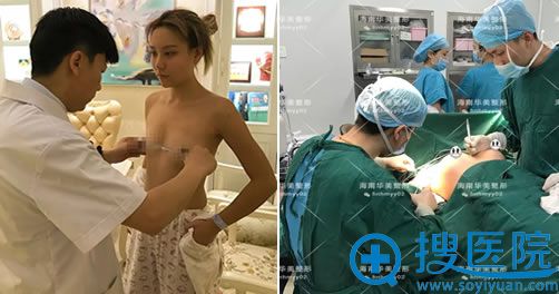 假体隆胸手术过程图 假体隆胸手术过程图