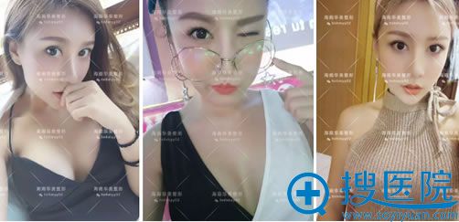 假体隆胸手术3个月的效果 假体隆胸手术3个月的效果