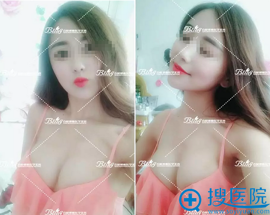 <!--<i data=20240710 data-id=12473></i>-->����������������15��