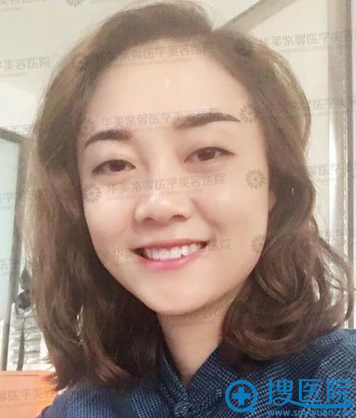 <!--<i data=20240710 data-id=13402></i>-->祛眼袋的效果 <!--<i data=20240710 data-id=13402></i>-->祛眼袋的效果