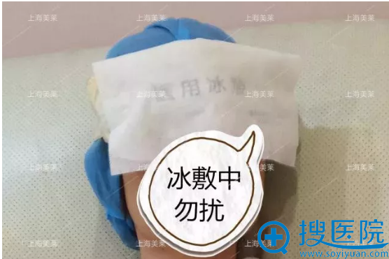 双眼皮恢复期冰敷阶段 双眼皮恢复期冰敷阶段