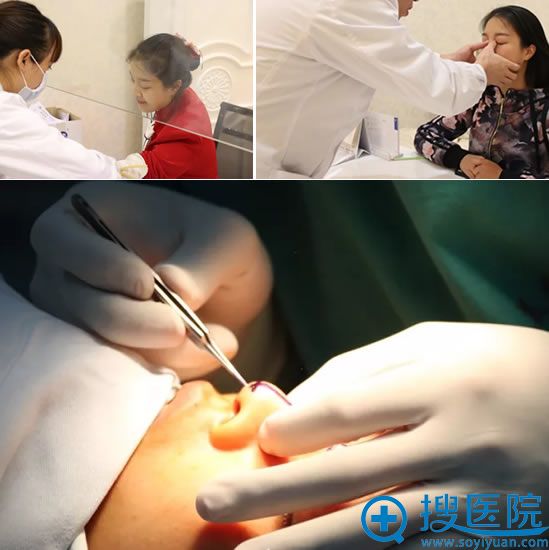 凤凤做隆鼻手术前面诊过程图 凤凤做隆鼻手术前面诊过程图