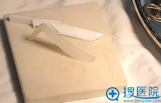 取出隆鼻失败假体照片 取出隆鼻失败假体照片