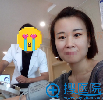 眼综合+自体脂肪填充+术前照 眼综合+自体脂肪填充+术前照