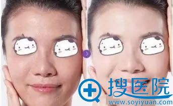 玉之光案例效果 玉之光案例效果