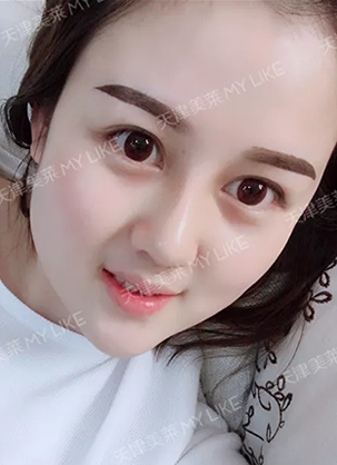 ���������˫ȫ¡�ǰ��������˶�������һ���»ָ�����