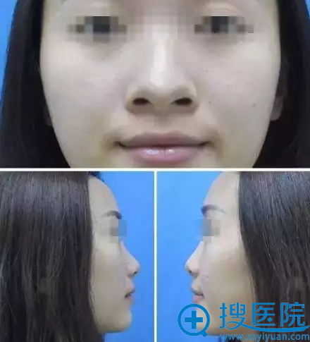 ��ͷ��ɭ��������ΰ���ۺ�����1������ʵ�ָ����ռ�