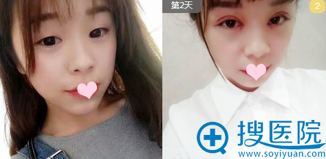 �����콨������ҽԺ���ֽ�˫��Ƥ����