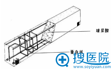 线雕+玻尿酸联合抗衰效果更好 线雕+玻尿酸联合抗衰效果更好