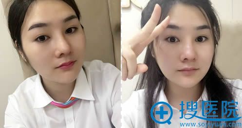 �Ҵ޶������ۺ�������ߵĻָ���