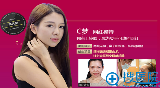 深圳美莱双眼皮+全面部玻尿酸精雕案例 深圳美莱双眼皮+全面部玻尿酸精雕案例