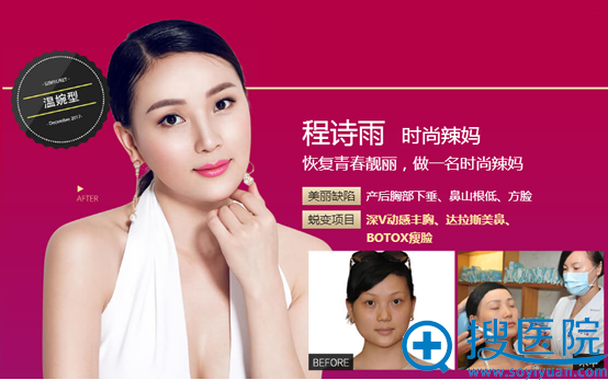 深圳美莱深V动感丰胸、瘦脸案例 深圳美莱深V动感丰胸、瘦脸案例