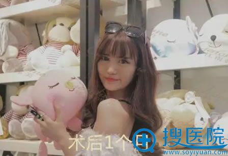 全切双眼皮手术1个月效果 全切双眼皮手术1个月效果