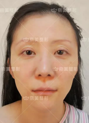 ������������ʤԺ������֬������沿��ʵ���� �������ô��