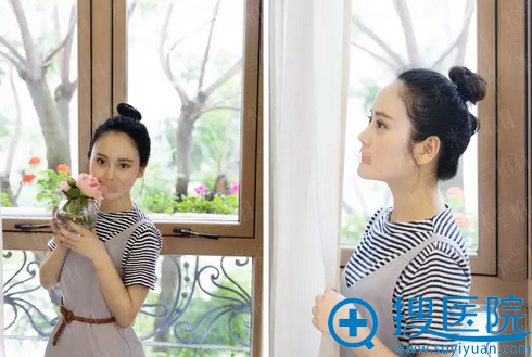 张槿旭院长鼻综合+自体脂肪面部填充术后效果 张槿旭院长鼻综合+自体脂肪面部填充术后效果