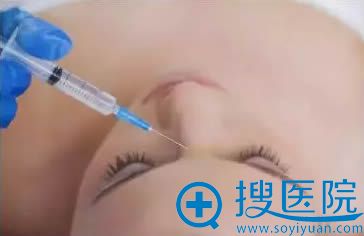 注射隆鼻失败的症状及修复方法 注射隆鼻失败的症状及修复方法