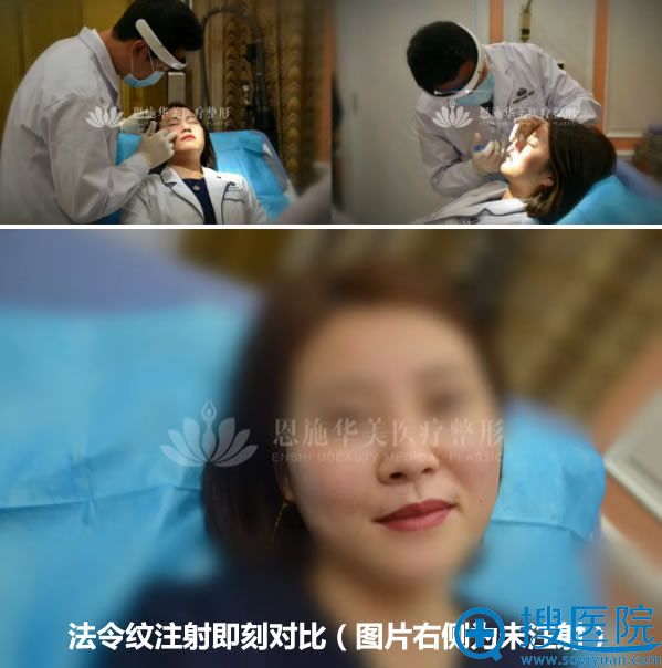 �������ֳ����鲣���������Ч��
