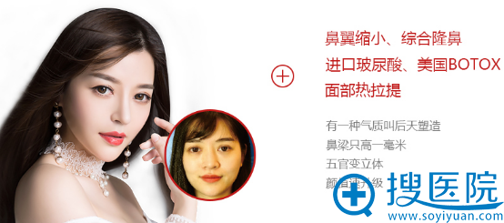 深圳非凡鼻综合整形案例 深圳非凡鼻综合整形案例