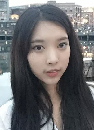 脸不对称怎么矫正?看我在韩国原辰做面部轮廓手术调整效果如何