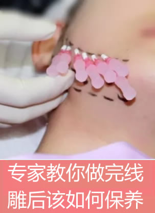 ������������΢��ʺ���������㣺�沿�ߵ����ô����