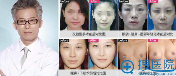 长沙美莱整形医生<!--<i data=20240710 data-id=16314></i>-->塑美案例 长沙美莱整形医生<!--<i data=20240710 data-id=16314></i>-->塑美案例