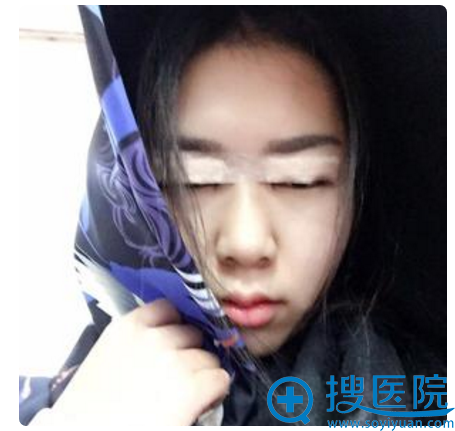 双眼皮手术当天情况 双眼皮手术当天情况