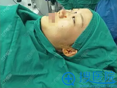 <!--<i data=20240710 data-id=15330></i>-->医疗美容陈邦胤术前设计 <!--<i data=20240710 data-id=15330></i>-->医疗美容陈邦胤术前设计