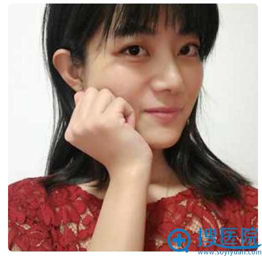 做完膨体隆鼻21天的我长这样 做完膨体隆鼻21天的我长这样