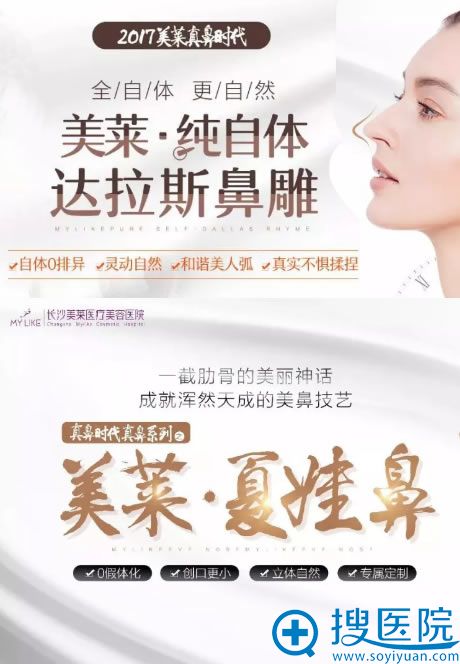 长沙美莱自体肋骨鼻雕技术 长沙美莱自体肋骨鼻雕技术