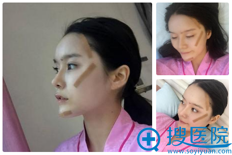 �������컪���ǿԺ���������Ч��ͼ
