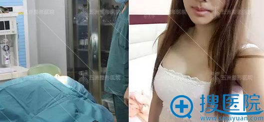 刘杨娜绮丽假体丰胸术后即刻效果 刘杨娜绮丽假体丰胸术后即刻效果